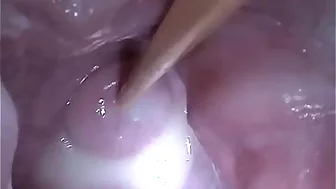 Insertion Semen Cum in Cervix Wide Stretching Pussy Speculum
